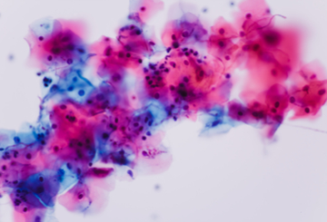 2017年第54届美国皮肤病理学协会年会（ASDP）