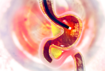 2018年第26届欧洲消化疾病周（UEGW）