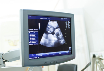 2019年92届日本超声医学会大会（JSUM）