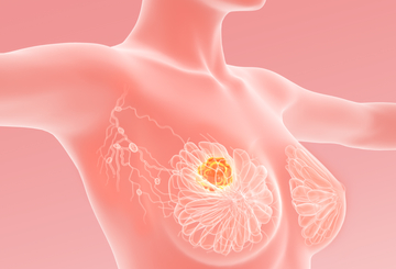 2019年第42届圣安东尼奥乳腺癌大会（SABCS）