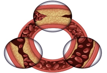 2019年第4届亚洲血浆质量和供应研讨会(IPFA)