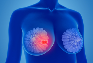 2019年第50届妇科肿瘤学会年会（SGO）