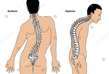 2019年第54届脊柱侧凸研究协会年会及课程（SRS）
