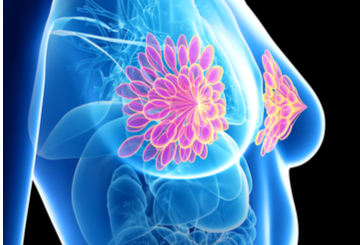 2021年欧洲肿瘤内科学会乳腺癌会议（ESMO-Breast）