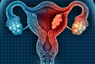 2024年第10届子宫内膜异位症与子宫疾病学大会（SEUD)