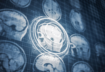 2025年国际人类脑图谱学会年会（OHBM)