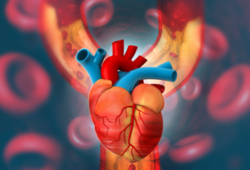 2023年先天性及结构性和瓣膜心脏病介入治疗法兰克福大会(CSI FRANKFURT)