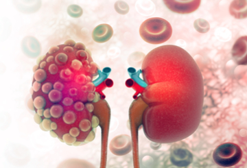 2021年世界肾脏病学大会（WCN）