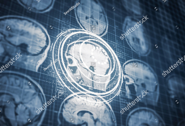 2024年美国立体定向和功能神经外科学会双年会（ASSFN)