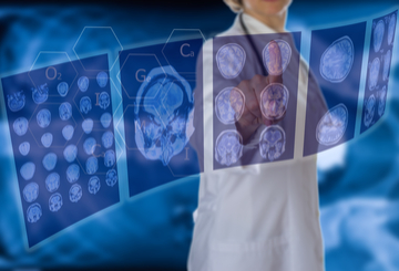 2016年世界神经介入治疗大会（WLNC）