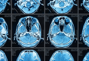 2015年27届国际脑血流与代谢功能研讨会（ISCBFM)