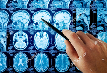 2026年阿尔茨海默病协会国际会议(AAIC)