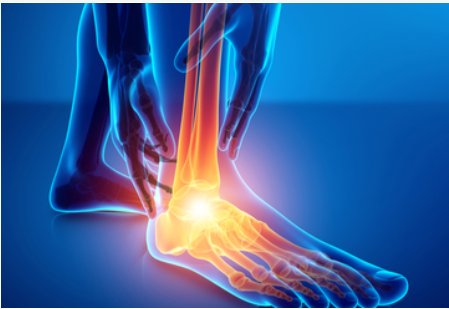 2020年第22届亚太风湿病学会联盟年会（APLAR)延期更新