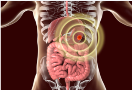 2020年国际乙型肝炎病毒大会（HBV)延期更新