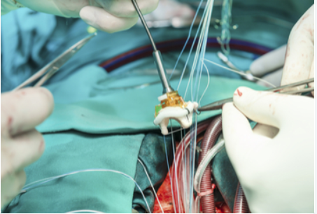 2020年第14届澳大利亚新西兰血管治疗大会（ANZET）延期更新