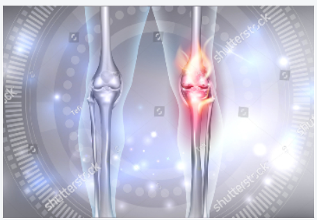 2020年第19届欧洲运动创伤、膝关节外科和关节镜学会大会（ESSKA)延期更新