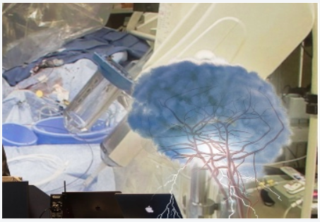 2020年第13届亚洲大洋洲癫痫大会（AOEC)延期更新