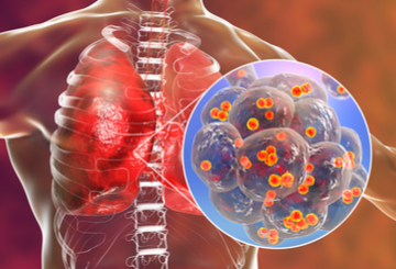 2026年欧洲肿瘤介入大会（ECIO）